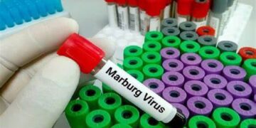 RI Waspada, Fatalitas Tinggi Akibat Virus Marburg