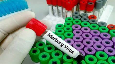 RI Waspada, Fatalitas Tinggi Akibat Virus Marburg