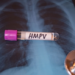 Virus HMPV Masuk RI, Kemenkes Imbau Masyarakat Tak Panik