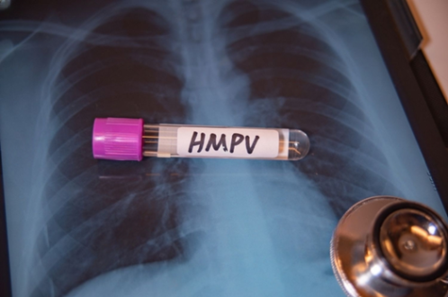 Virus HMPV Masuk RI, Kemenkes Imbau Masyarakat Tak Panik
